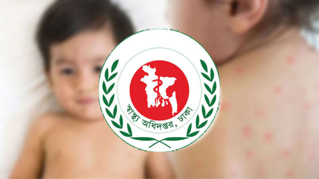 ২৪ ঘণ্টায় হাম ও উপসর্গে আরও ৫ শিশুর মৃত্যু, মোট প্রাণহানি ৭৯৩