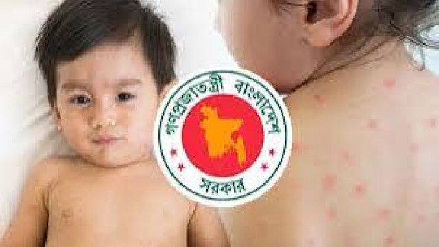 দেশে হামের উপসর্গে আরও ৪ শিশুর মৃত্যু, নতুন আক্রান্ত ১০৫১