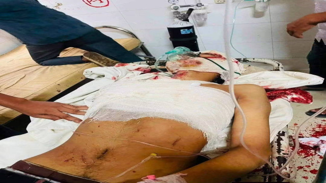 আরাফাতকে ঢাকায় পাঠাতে দেরির অভিযোগ, ববি শিক্ষার্থীদের সড়ক অবরোধ
